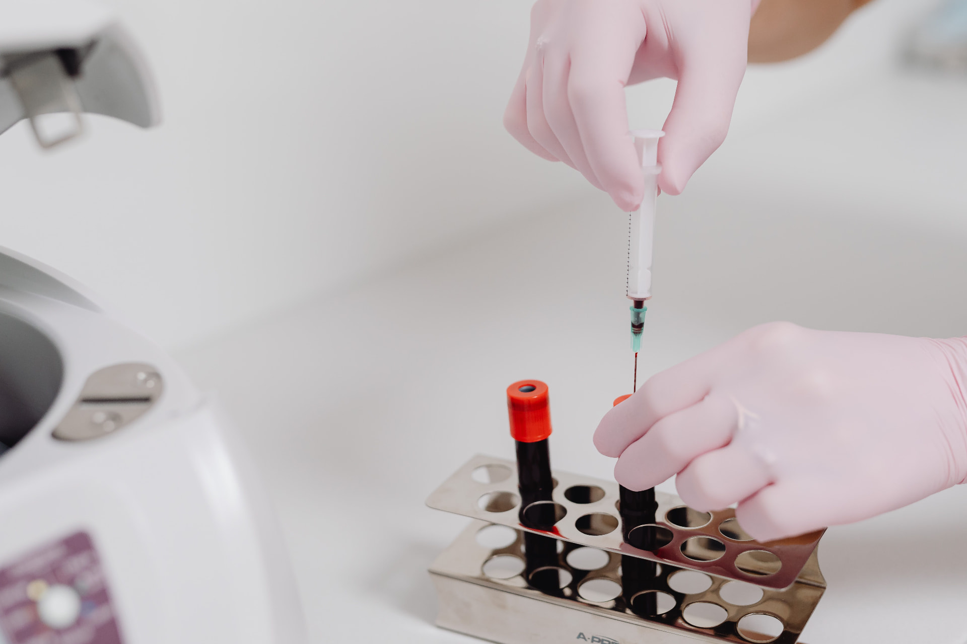 Préparation d’une seringue de PRP en clinique